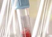 Astrazeneca 2 of 5